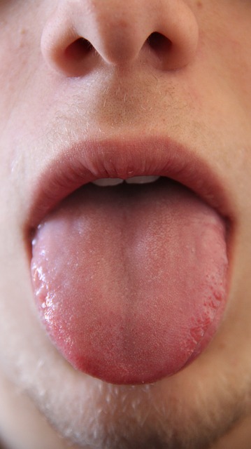 Tagli sulla lingua: come curarli? Quando ci sono rischi d’infezione?